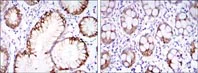 Immunohistochemistry (Formalin/PFA-fixed paraffin-embedded sections) - Anti-Carbonic Anhydrase 9/CA9 antibody [2D3] (AB107257)