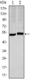 Western blot - Anti-Carbonic Anhydrase 9/CA9 antibody [2D3] (AB107257)