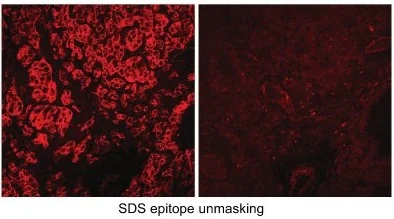 Immunohistochemistry (Frozen sections) - Anti-Carbonic Anhydrase 9/CA9 antibody (AB15086)