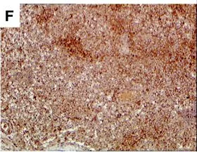 Immunohistochemistry - Anti-Carbonic Anhydrase 9/CA9 antibody (AB15086)