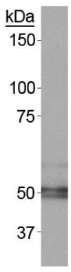 Western blot - Anti-Carbonic Anhydrase 9/CA9 antibody (AB15086)