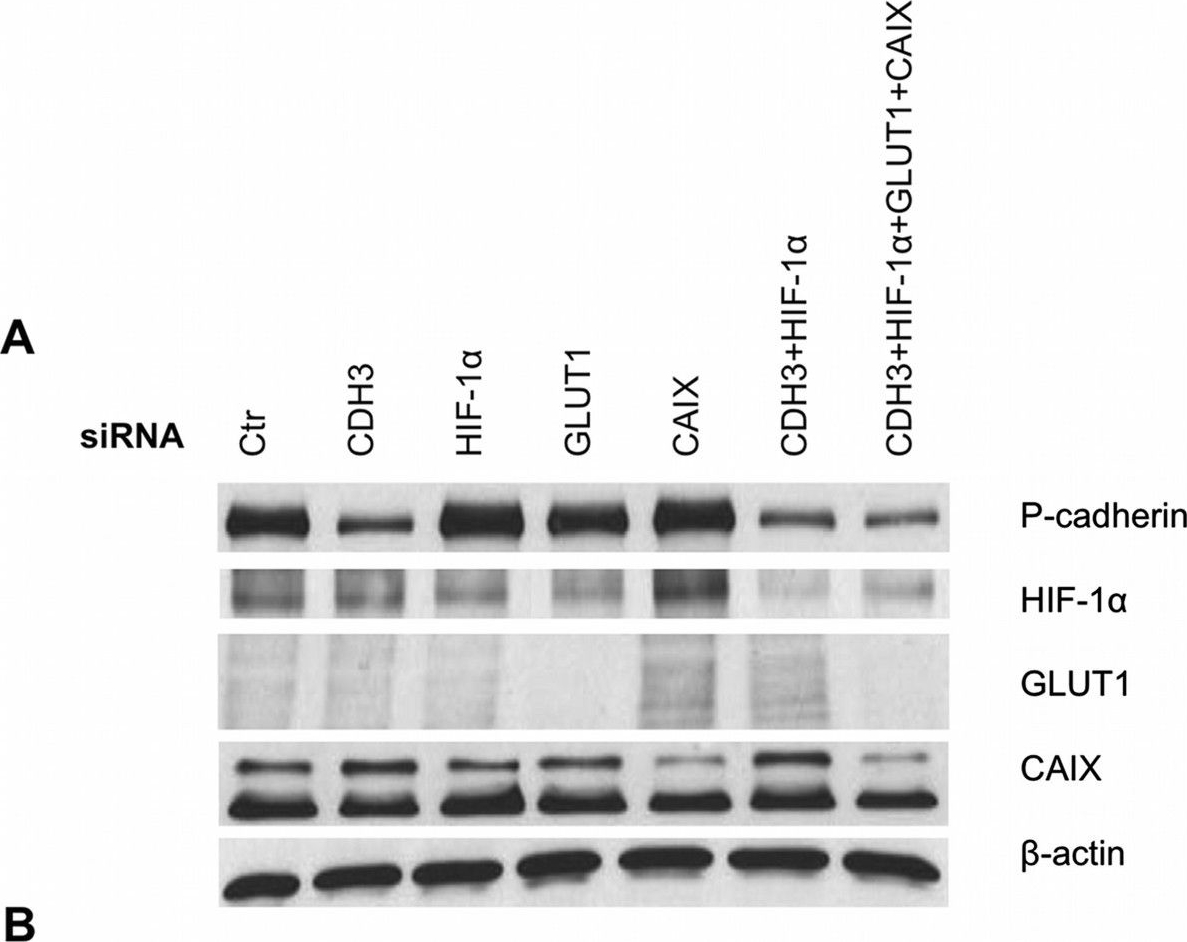Anti-Carbonic Anhydrase 9/CA9 antibody (ab15086) | Abcam