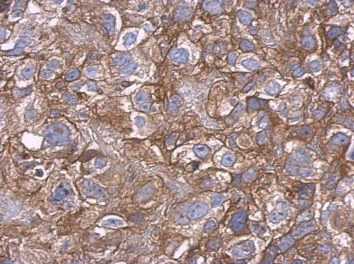 Immunohistochemistry (Formalin/PFA-fixed paraffin-embedded sections) - Anti-Carbonic Anhydrase 9/CA9 antibody (AB184006)