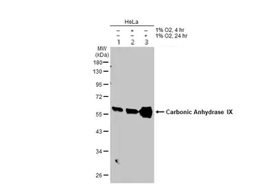 Western blot - Anti-Carbonic Anhydrase 9/CA9 antibody (AB184006)