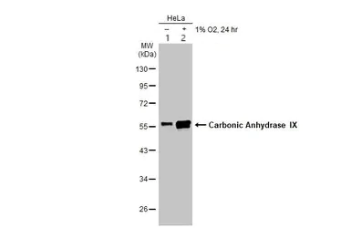 Western blot - Anti-Carbonic Anhydrase 9/CA9 antibody (AB184006)