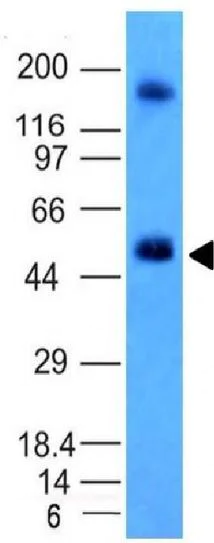 Western blot - Anti-Carbonic Anhydrase 9/CA9 antibody [CA9/781] (AB216021)