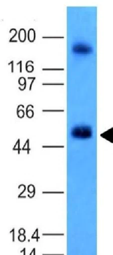 Western blot - Anti-Carbonic Anhydrase 9/CA9 antibody [CA9/781] - BSA and Azide free (AB212962)