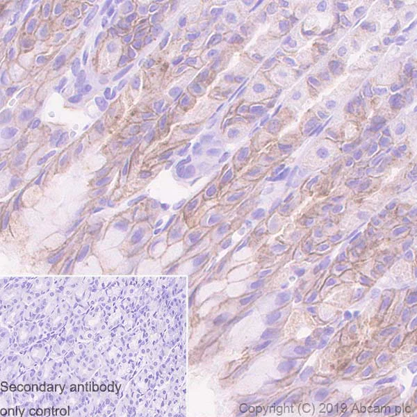 Immunohistochemistry (Formalin/PFA-fixed paraffin-embedded sections) - Anti-Carbonic Anhydrase 9/CA9 antibody [EPR23055-5] (AB243660)