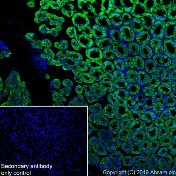 Immunohistochemistry (Frozen sections) - Anti-Carbonic Anhydrase 9/CA9 antibody [EPR23055-5] (AB243660)