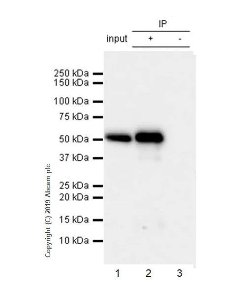 Immunoprecipitation - Anti-Carbonic Anhydrase 9/CA9 antibody [EPR23055-5] (AB243660)