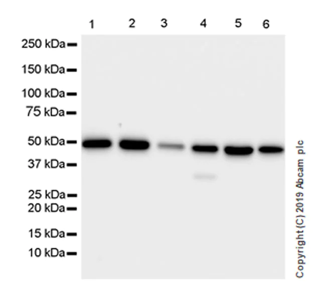 Western blot - Anti-Carbonic Anhydrase 9/CA9 antibody [EPR23055-5] (AB243660)