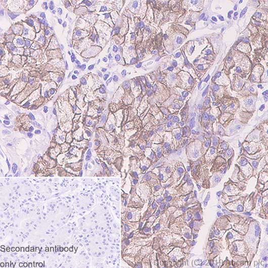 Immunohistochemistry (Formalin/PFA-fixed paraffin-embedded sections) - Anti-Carbonic Anhydrase 9/CA9 antibody [EPR23055-5] - BSA and Azide free (AB270401)