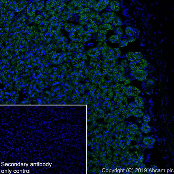 Immunohistochemistry (Frozen sections) - Anti-Carbonic Anhydrase 9/CA9 antibody [EPR23055-5] - BSA and Azide free (AB270401)