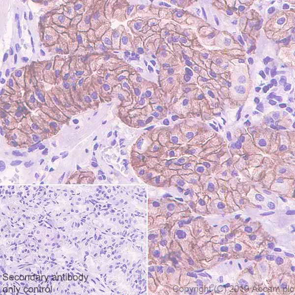 Immunohistochemistry (Formalin/PFA-fixed paraffin-embedded sections) - Anti-Carbonic Anhydrase 9/CA9 antibody [EPR4151(2)] (AB108351)