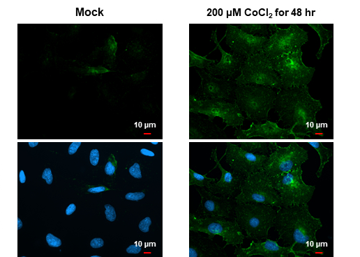 Immunocytochemistry/ Immunofluorescence - Anti-Carbonic Anhydrase 9/CA9 antibody [HL1410] - BSA and Azide free (AB313848), expandable thumbnail