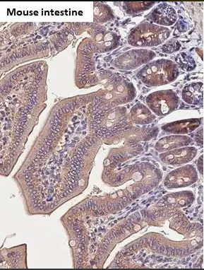 Immunohistochemistry (Formalin/PFA-fixed paraffin-embedded sections) - Anti-Carbonic Anhydrase 9/CA9 antibody [HL1410] - BSA and Azide free (AB313848), expandable thumbnail