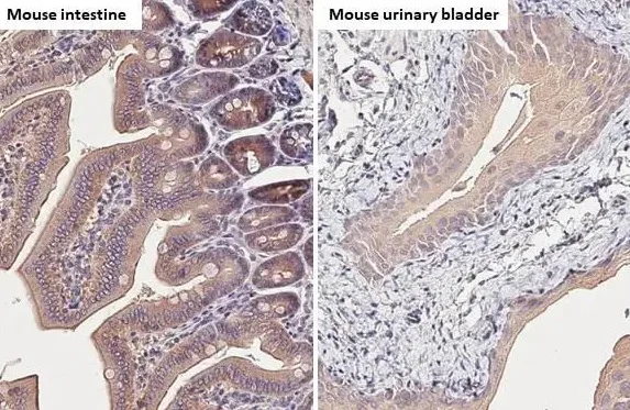 Immunohistochemistry (Formalin/PFA-fixed paraffin-embedded sections) - Anti-Carbonic Anhydrase 9/CA9 antibody [HL1410] - BSA and Azide free (AB313848)