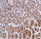Immunohistochemistry (Formalin/PFA-fixed paraffin-embedded sections) - Anti-Carbonic Anhydrase 9/CA9 antibody [SP106] - BSA and Azide free (AB243910)