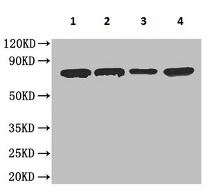 Western blot - Anti-Carboxylesterase 1C antibody (AB193485), expandable thumbnail