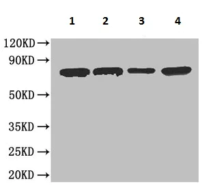 Western blot - Anti-Carboxylesterase 1C antibody (AB193485)