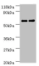 Western blot - Anti-Carboxylesterase 1C antibody (AB193485)
