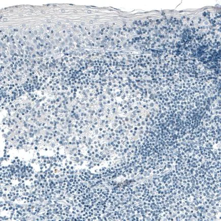Immunohistochemistry (Formalin/PFA-fixed paraffin-embedded sections) - Anti-Carboxypeptidase A antibody [CL6629] (AB243039)