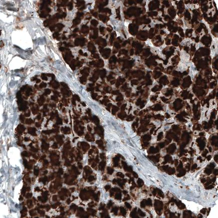 Immunohistochemistry (Formalin/PFA-fixed paraffin-embedded sections) - Anti-Carboxypeptidase A antibody [CL6629] (AB243039)