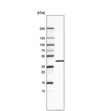 Western blot - Anti-Carboxypeptidase A antibody [CL6629] (AB243039)