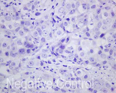 Immunohistochemistry (Formalin/PFA-fixed paraffin-embedded sections) - Anti-Carboxypeptidase A antibody [EPR12086] (AB173283), expandable thumbnail