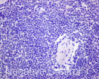 Immunohistochemistry (Formalin/PFA-fixed paraffin-embedded sections) - Anti-Carboxypeptidase A antibody [EPR12086] (AB173283), expandable thumbnail