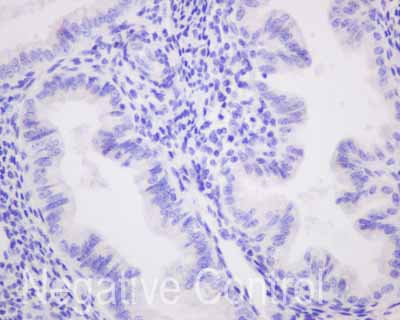 Immunohistochemistry (Formalin/PFA-fixed paraffin-embedded sections) - Anti-Carboxypeptidase A antibody [EPR12086] (AB173283), expandable thumbnail