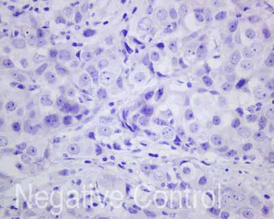 Immunohistochemistry (Formalin/PFA-fixed paraffin-embedded sections) - Anti-Carboxypeptidase A antibody [EPR12086] - BSA and Azide free (AB249747)