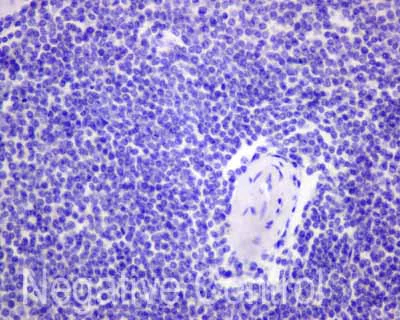 Immunohistochemistry (Formalin/PFA-fixed paraffin-embedded sections) - Anti-Carboxypeptidase A antibody [EPR12086] - BSA and Azide free (AB249747)