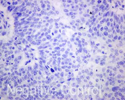 Immunohistochemistry (Formalin/PFA-fixed paraffin-embedded sections) - Anti-Carboxypeptidase A antibody [EPR12086] - BSA and Azide free (AB249747)