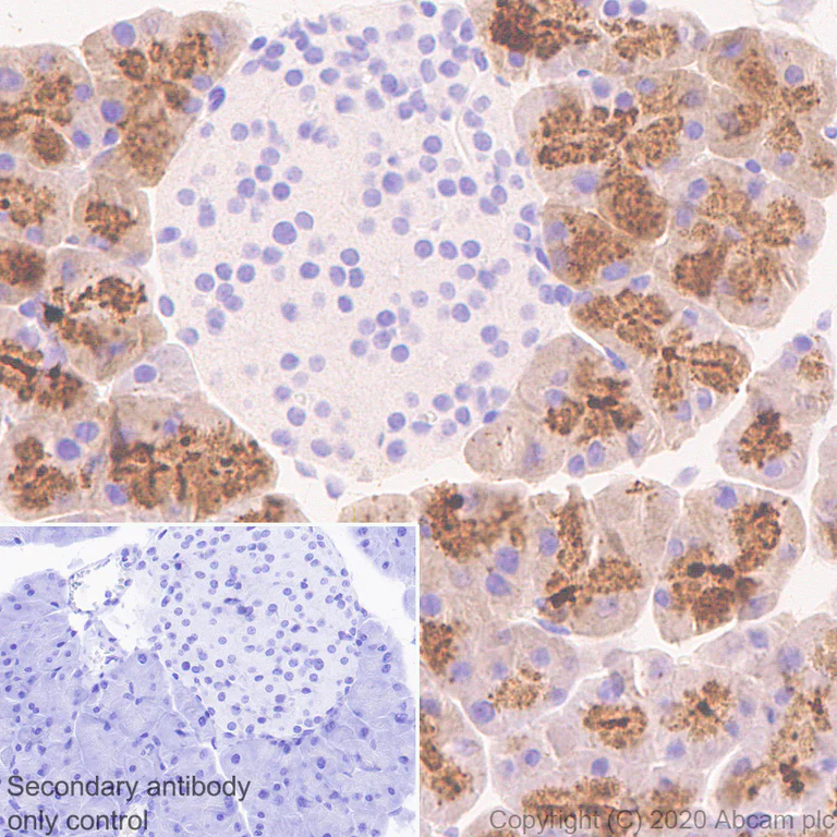 Immunohistochemistry (Formalin/PFA-fixed paraffin-embedded sections) - Anti-Carboxypeptidase A antibody [EPR24384-69] (AB278044)