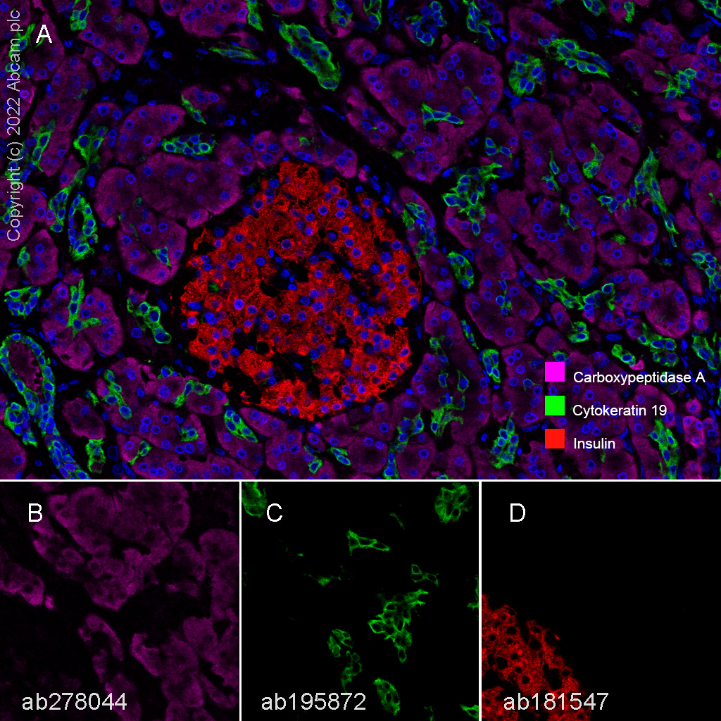 Multiplex immunohistochemistry - Anti-Carboxypeptidase A antibody [EPR24384-69] - BSA and Azide free (ab278047), expandable thumbnail