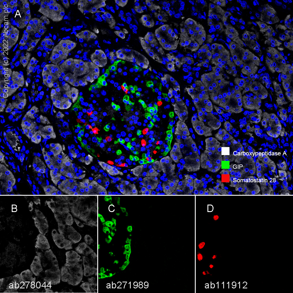 Multiplex immunohistochemistry - Anti-Carboxypeptidase A antibody [EPR24384-69] - BSA and Azide free (ab278047), expandable thumbnail