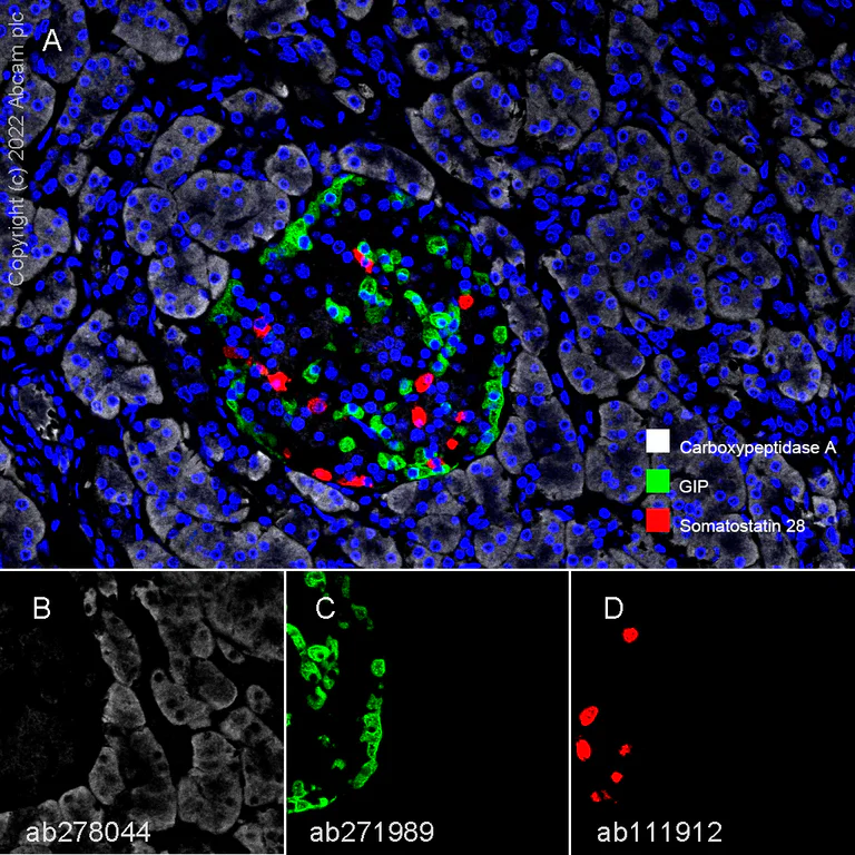 Multiplex immunohistochemistry - Anti-Carboxypeptidase A antibody [EPR24384-69] - BSA and Azide free (AB278047)