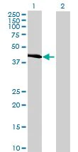 Western blot - Carboxypeptidase A overexpression 293T lysate (whole cell) (AB94084)