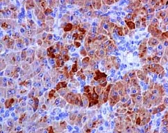 Immunohistochemistry (Formalin/PFA-fixed paraffin-embedded sections) - Anti-Carboxypeptidase A1+A2+B antibody [EPR12087(B)] - BSA and Azide free (AB250379)