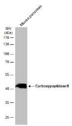 Western blot - Anti-Carboxypeptidase B/CPB antibody (AB153716), expandable thumbnail