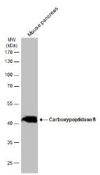 Western blot - Anti-Carboxypeptidase B/CPB antibody (AB153716)