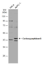 Western blot - Anti-Carboxypeptidase B/CPB antibody (AB153716), expandable thumbnail