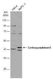 Western blot - Anti-Carboxypeptidase B/CPB antibody (AB153716)