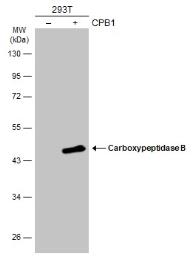 Western blot - Anti-Carboxypeptidase B/CPB antibody (AB153716), expandable thumbnail