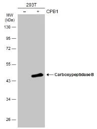 Western blot - Anti-Carboxypeptidase B/CPB antibody (AB153716)