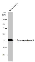 Western blot - Anti-Carboxypeptidase B/CPB antibody (ab153716), expandable thumbnail