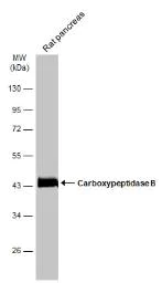 Western blot - Anti-Carboxypeptidase B/CPB antibody (AB153716)