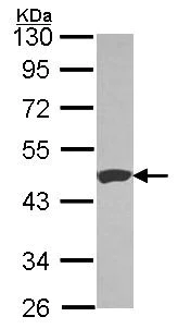 Western blot - Anti-Carboxypeptidase B/CPB antibody (AB153716)