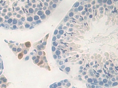 Immunohistochemistry (Formalin/PFA-fixed paraffin-embedded sections) - Anti-Carboxypeptidase B/CPB antibody (ab231536), expandable thumbnail